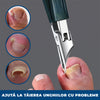 NailCut Pro – Set 3 Piese pentru Tăierea și Îngrijirea Unghiilor cu Probleme