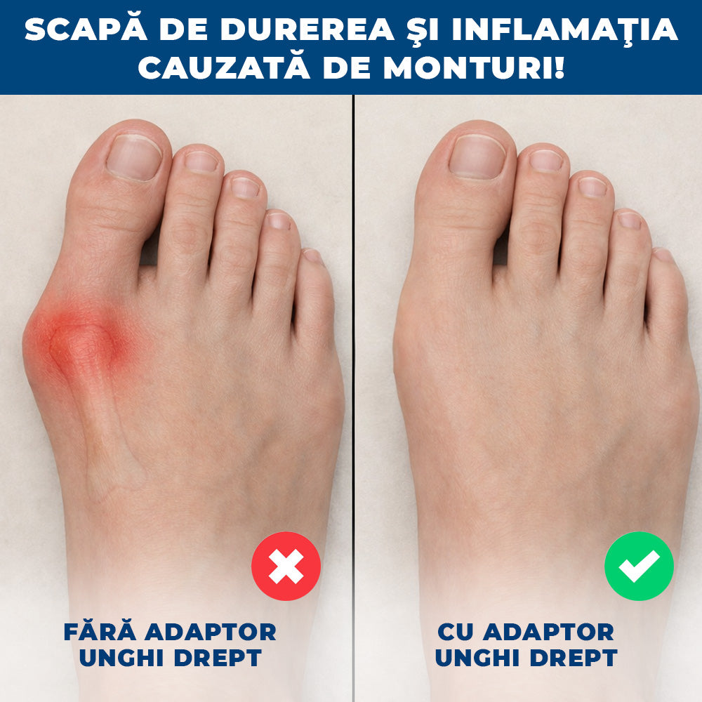 MontCorrect - Set 2 Bandaje Ortopedice pentru Monturi și Degete Strâmbe